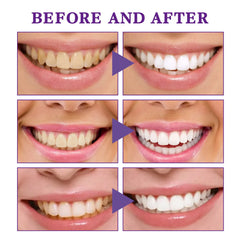 Mousse Nettoyante Dents V34